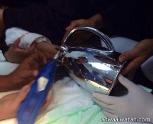 مدني الرياض يحرر يد طفلة من “ترمس شاي”