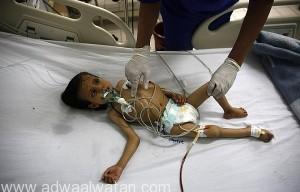 منظمة الصحة العالمية تسعى للحصول على التمويل وإيصال المساعدات الطبية في اليمن