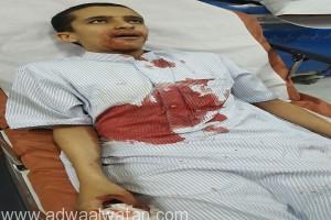 شاب يدخل في غيبوبة بعد خلع ضرسه بالنماص