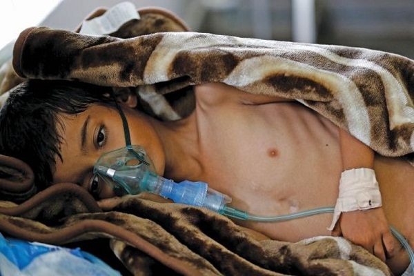 “الحكومة اليمنية” : إعلان الطوارئ الصحية بأربع محافظات ‏جنوبية جاء لضرورة وطنية