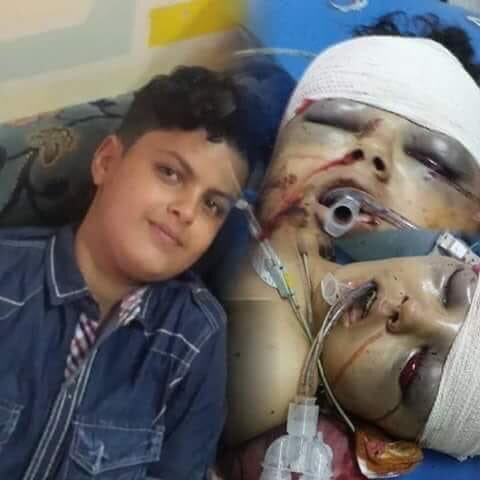 وزير الإعلام اليمني يؤكد أن مقتل الطفل برصاصة القائد الحوثي الديلمي جريمة واستهتار بدماء الشعب