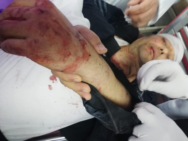 إصابة المتحدث باسم حركة فتح إثر تعرضه للاعتداء من قِبل مسلحين