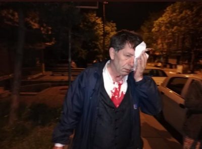 هجوم بمضارب بيسبول على صحافي معارض لأردوغان