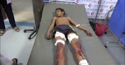 مقتل وإصابة طفليْن شقيقيْن في انفجار مقذوف حوثي