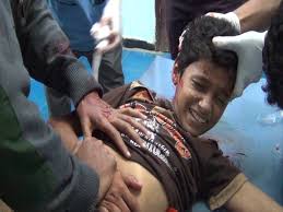 مقتل طفل وجرح 3 آخرين بقصف حوثي على محافظة تعز في اليمن