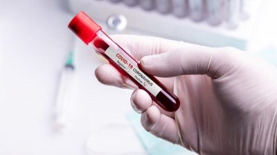 الصحة العالمية تحذر: علاج كورونا ببلازما الدم غير قاطع