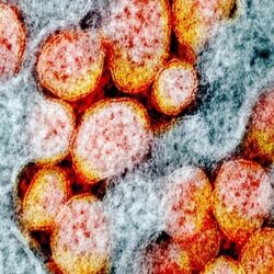 هل يحارب البروكلي أعراض الإنفلونزا ونزلات البرد؟