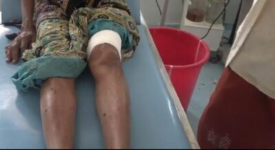إصابة امرأة مسنة بقناصات الحوثي.. والقوات المشتركة تتعامل مع”12″ طائرة مسيرة بالحديدة