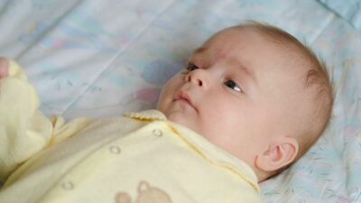 انتبه.. 8 علامات تدل على مرض التوحد عند الأطفال الرضع