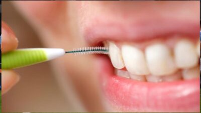 نصائح ذهبية لتنظيف الفراغات بين الأسنان