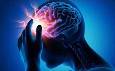 «فهد الطبية» تحدِّد 5 عادات للوقاية من الإصابة بالسكتة الدماغية