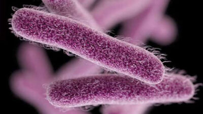بكتيريا شيجيلا تسبب التسمم لـ 57 أردنيًا.. ووزارة الصحة توضح التفاصيل