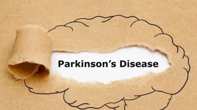 باب أمل لمرضى باركنسون.. علاج جديد قد يكون فعالاً