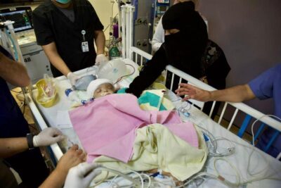 الفريق الجراحي لفصل التوأم اليمني الملتصق بالرأس يعلنُ وفاة أحدهما