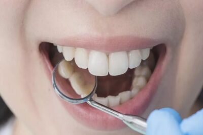 بخطوات منزلية بسيطة.. يمكنك الحفاظ على صحة أسنانك