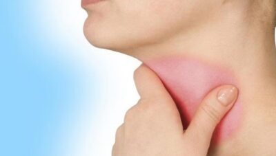 الصوت الخشن يمكن أن يكون علامة على أمراض خطيرة