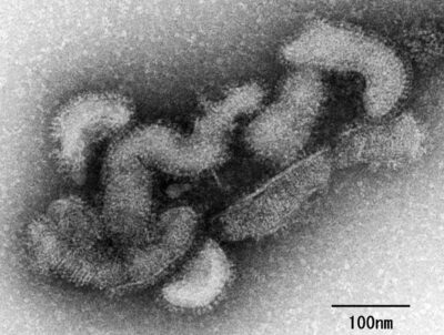 اليابان تعلن عن أول حالة وفاة في العالم بفيروس “أوز”