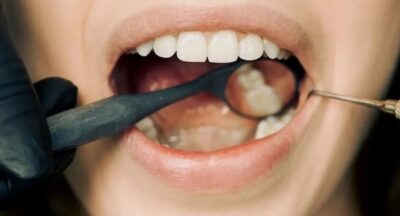 جفاف الفم.. علامة “حمراء” على 5 أمراض خطيرة