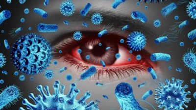 هل يمكن أن يكون فيروس كورونا وراء وباء العين الوردية؟