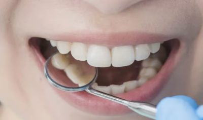 أحدها يوجِب مراجعة الطبيب فورًا.. أخصائية روسية تكشف أبرز 4 أنواع لألم الأسنان