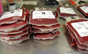 مستشفى جازان العام ينقل دم مصاب بالإيدز لفتاة عشرينية